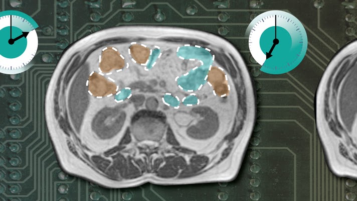 Annotated abdominal scan representing GI tract segmentation