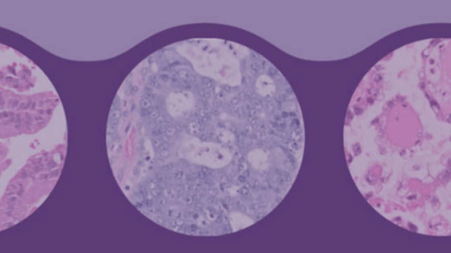 Microscopy samples from the HuBMAP vasculature challenge