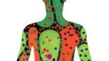 Illustration representing ovarian cancer subtype classification